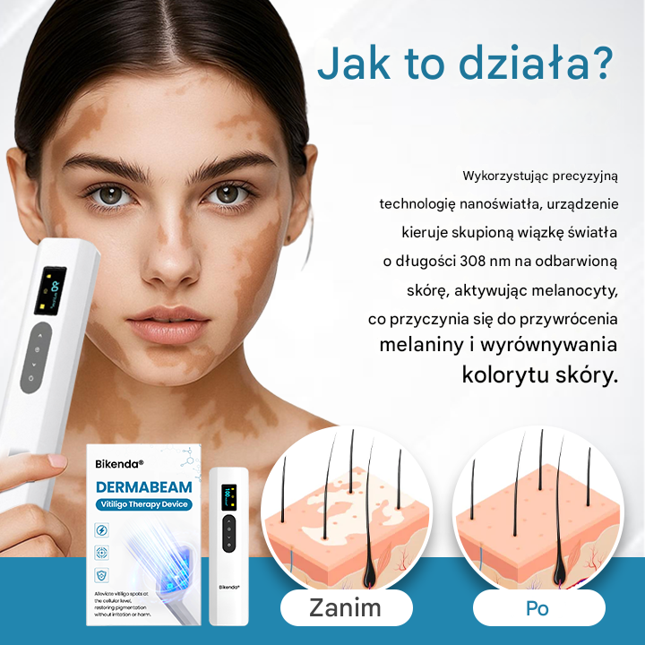 ✅Urządzenie do terapii bielactwa Bikenda® DermaBeam