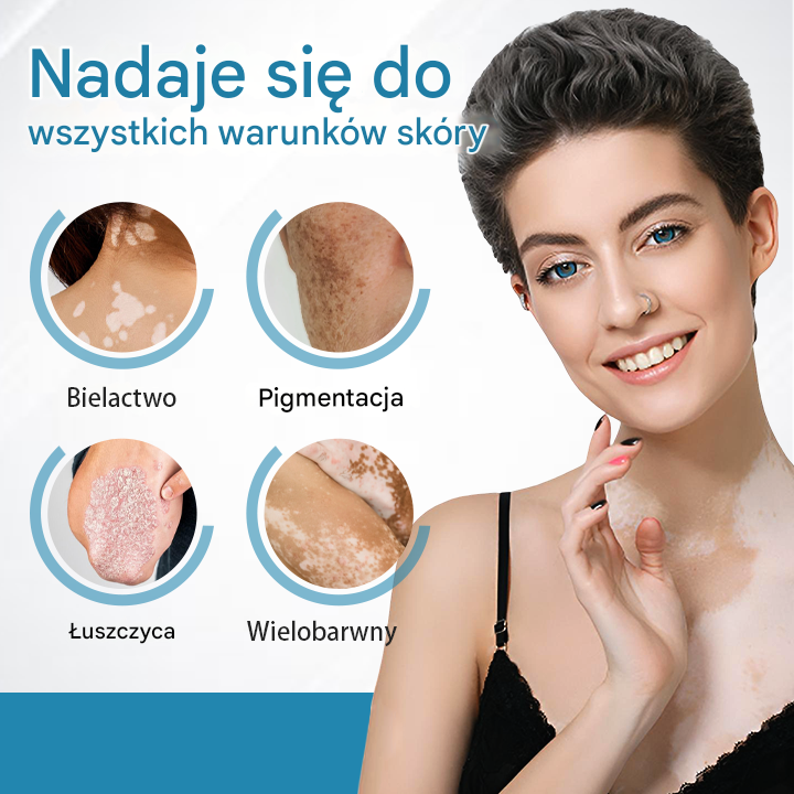 ✅Urządzenie do terapii bielactwa Bikenda® DermaBeam