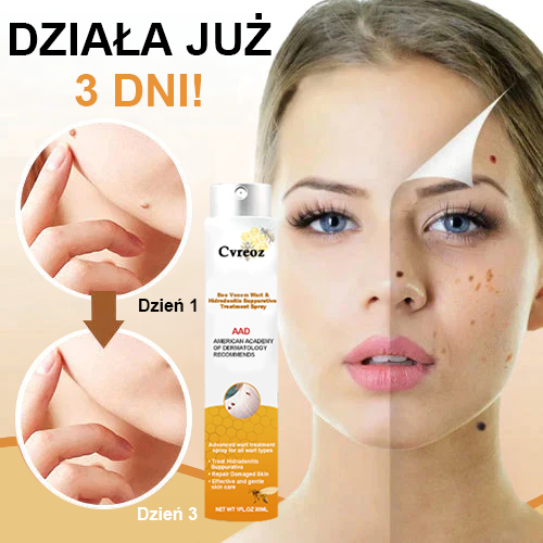 🧡Cvreoz Preparat do usuwania brodawek i znamion z jadem pszczelim Spray (👨⚕AAD POLECA)🐝🐝 (🔥Ostatni dzień promocji 80% taniej)