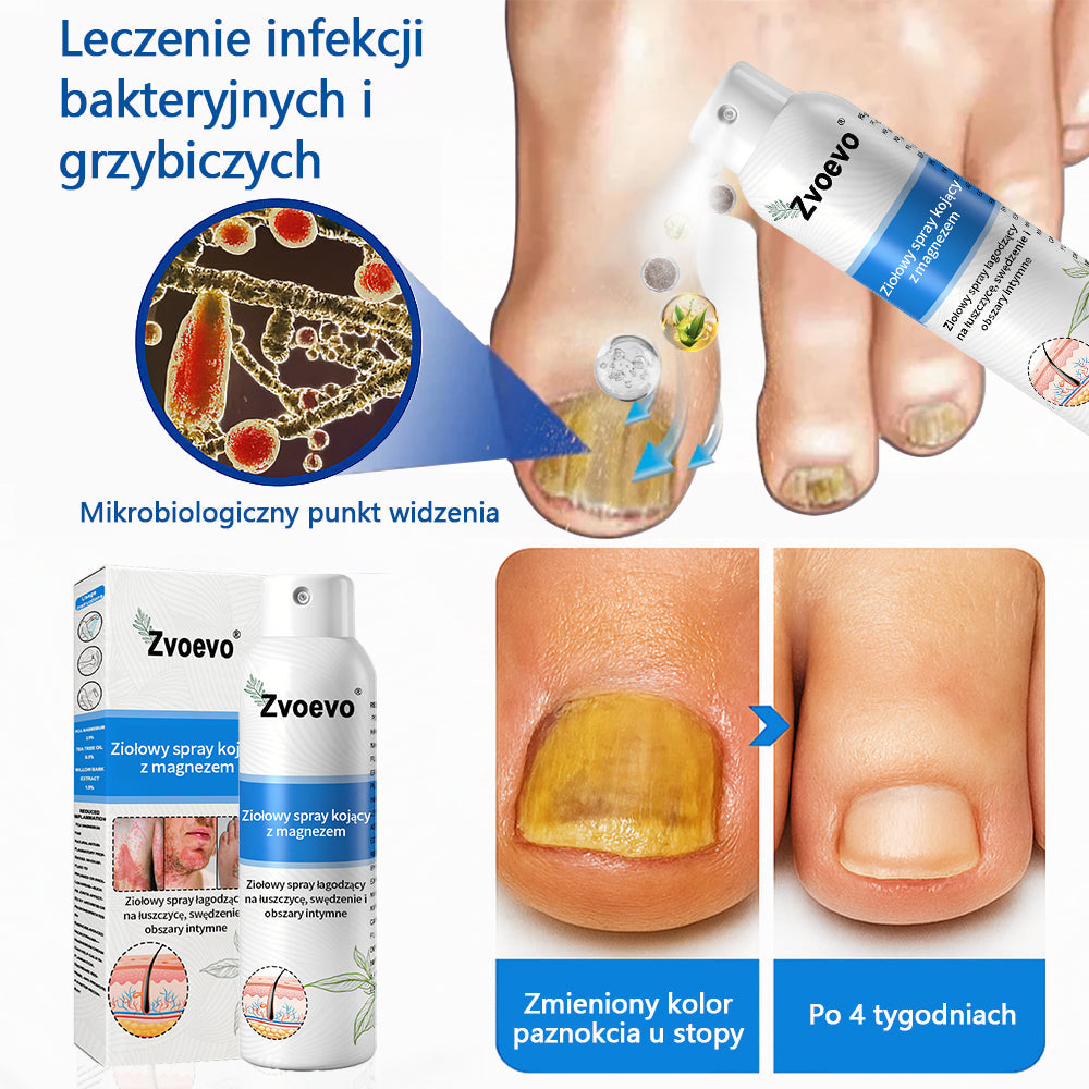 Oficjalny sklep✅: Zvoevo®Magnezowy spray ziołowy na łuszczycę⚕️Certyfikowany przez URPL (ulga w łuszczycy i egzemie, poprawa stanu bakteryjnych infekcji narządów płciowych oraz leczenie trądziku i przebarwień)✨✨✨✨