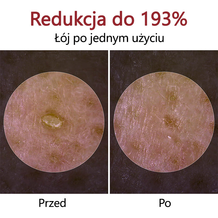 Ampułka Biancat® Peel Shot Glow Black Rice🌿🌿