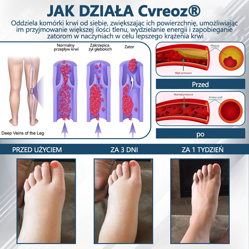 Detoksykujący krem ziołowy z czarnym kminkiem Cvreoz®🩹