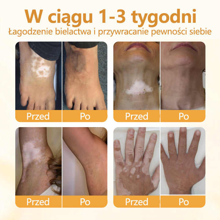 Timilk® VitiCalm krem z jadem pszczelim🌻🌻🌻