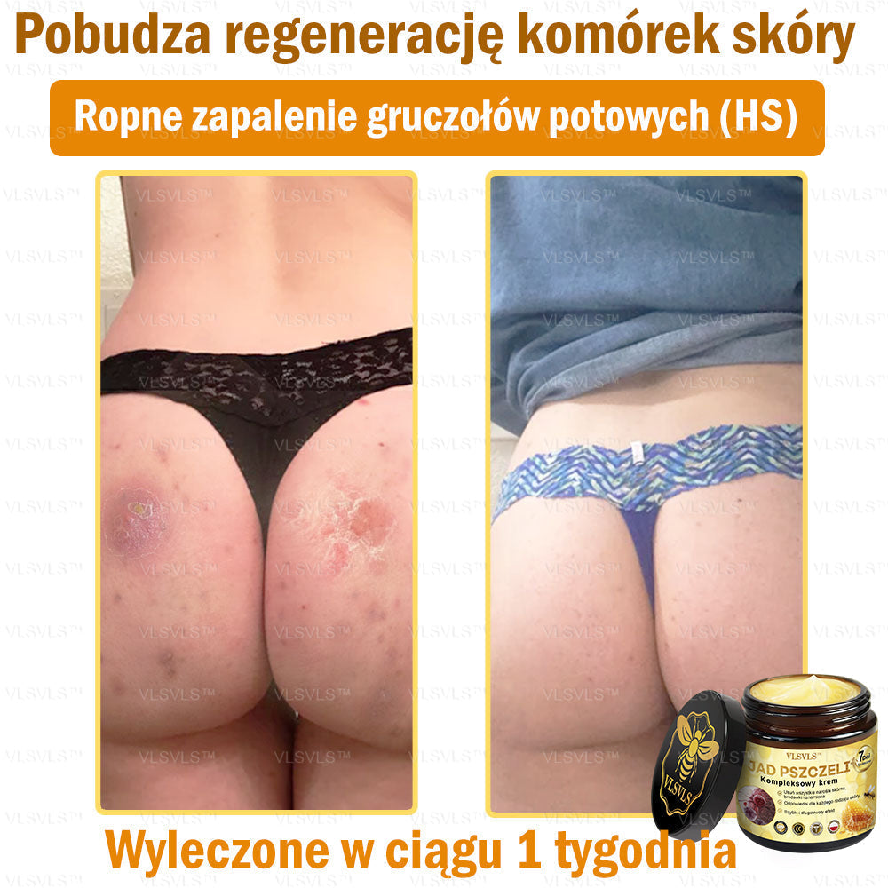 VLSVLS™ Krem Komprehensywny z Jadami Pszczół 🇵🇱 Rekomendowany przez Dermatologów
