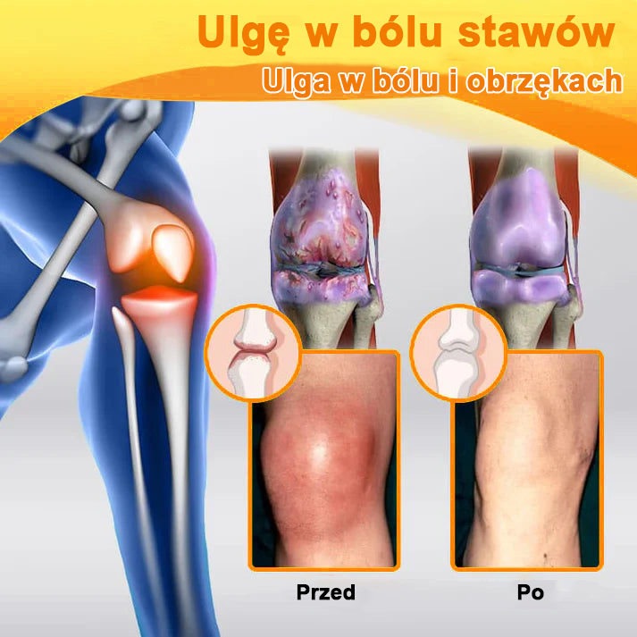 ✨✨✨✨Oficjalny sklep: Ouryard™ Olej magnezowy i miód w sprayu do naprawy stawów👨⚕️Zatwierdzony przez Polską Agencję Leków, Wyrobów Medycznych i Produktów Biologicznych (URPL)🔥
