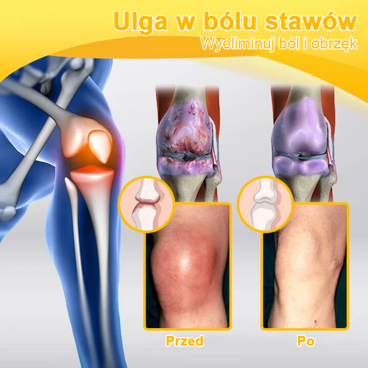 🌿🌿TLOPA® Toksyna botulinowa i jad pszczeli Balsam Łagodzący Ból i Leczenie Kości🐝 (Polecane dla seniorów przez ortopedów)🔥