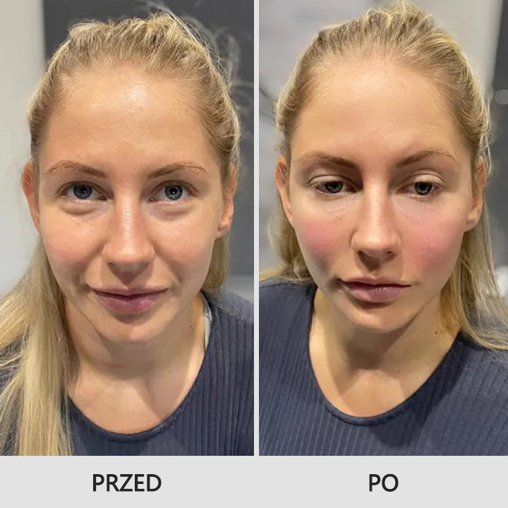 LIMETOW™ Retinol Eye Stick✅ redukuje drobne zmarszczki, opuchliznę i cienie pod oczami🌟