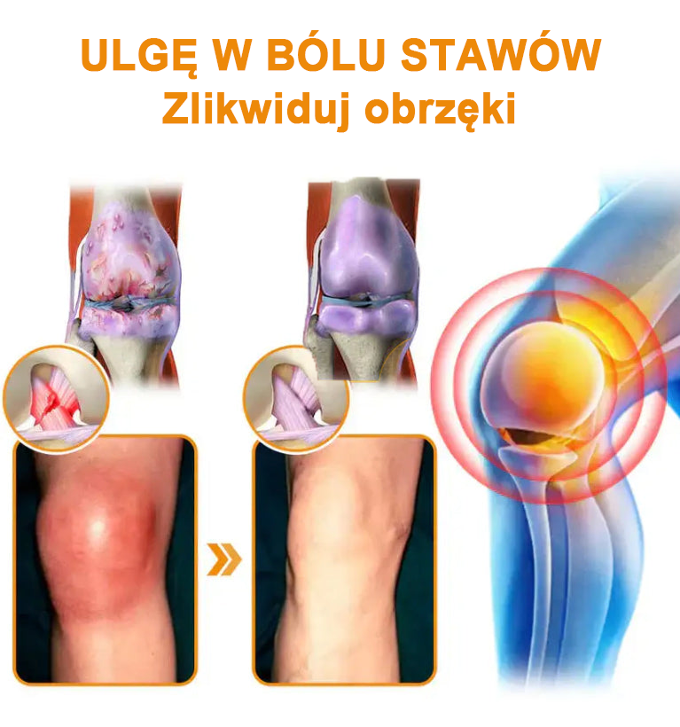 ✨✨✨✨Oficjalny sklep: Ouryard™ Olej magnezowy i miód w sprayu do naprawy stawów👨⚕️Zatwierdzony przez Polską Agencję Leków, Wyrobów Medycznych i Produktów Biologicznych (URPL)🔥