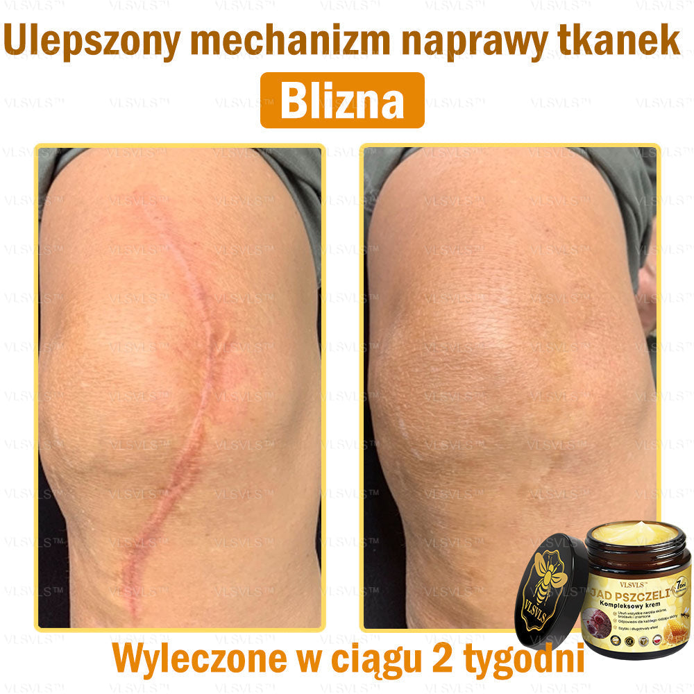 VLSVLS™ Krem Komprehensywny z Jadami Pszczół 🇵🇱 Rekomendowany przez Dermatologów