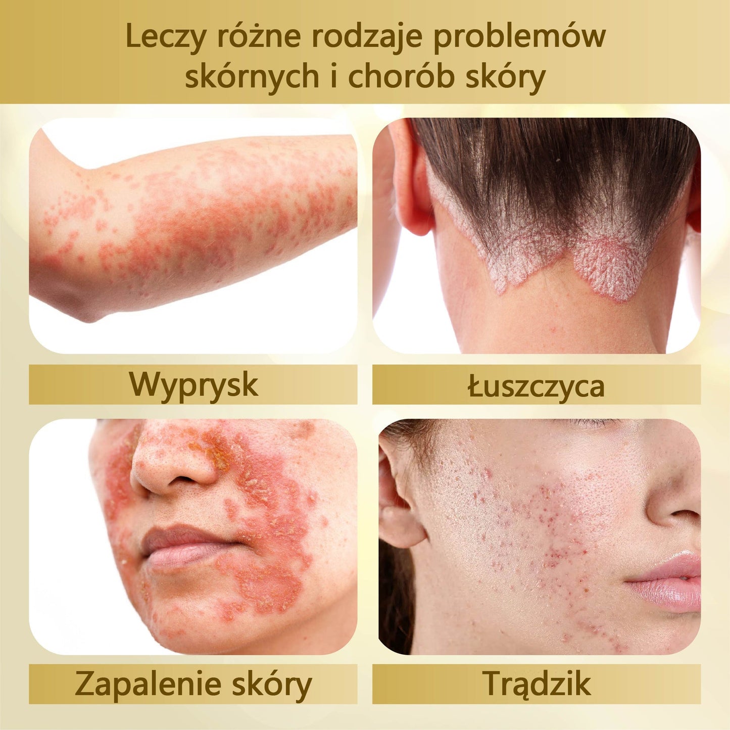 Krem regenerujący skórę Croaie® condense mellifera ⭐️⭐️