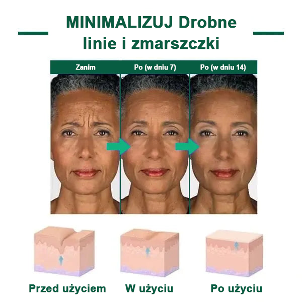 🌿🌿🌿🌿Ostatni dzień promocji 60% Zniżki - Fubsta™ Serum odmładzające ujędrniające skórę🔥🔥🔥🔥