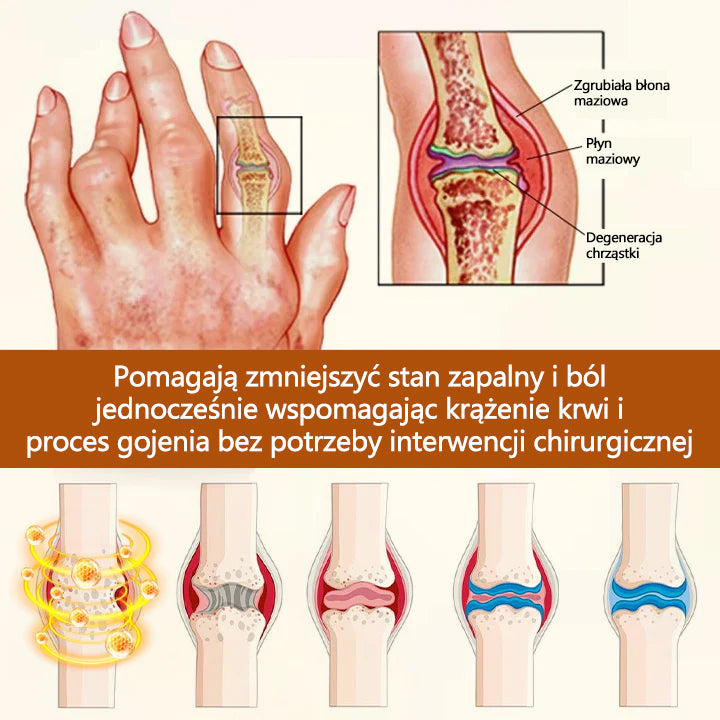 🔥🔥Timilk® VenomEase Krem do stawów