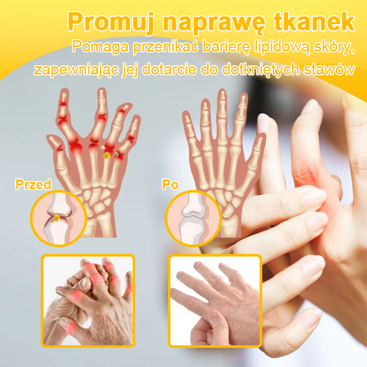 TLOPA® Toksyna botulinowa i jad pszczeli Balsam Łagodzący Ból i Leczenie Kości🐝🐝🌿 (Polecane dla seniorów przez ortopedów)🔥🔥