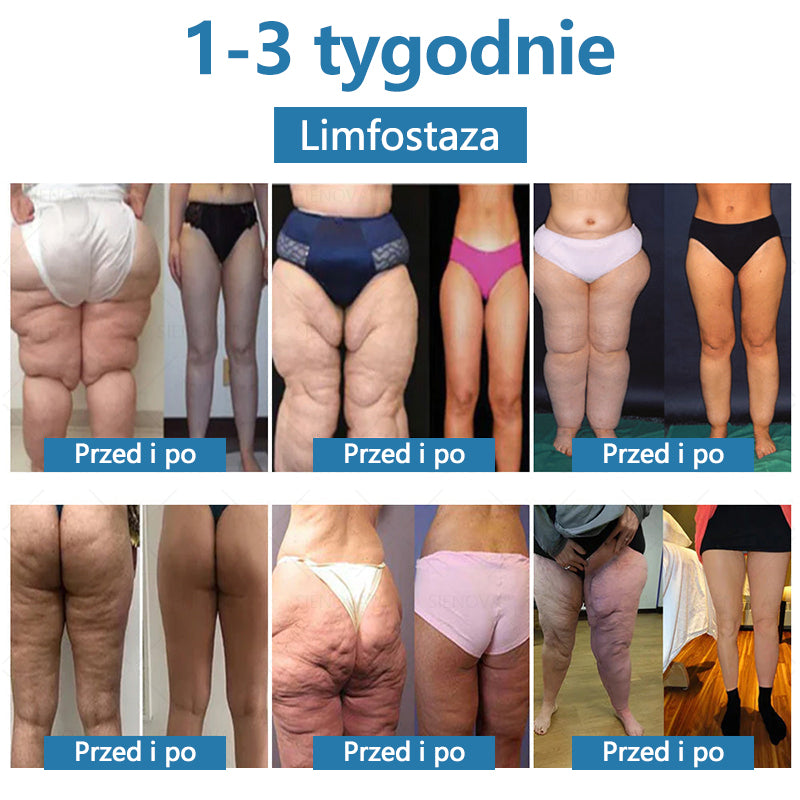 SIENOVA™💎 Przenośne urządzenie limfatyczne i rozluźniające stawy Urządzenie👨⚕️ Oryginalna terapia 2 w 1 | Certyfikat URPL
