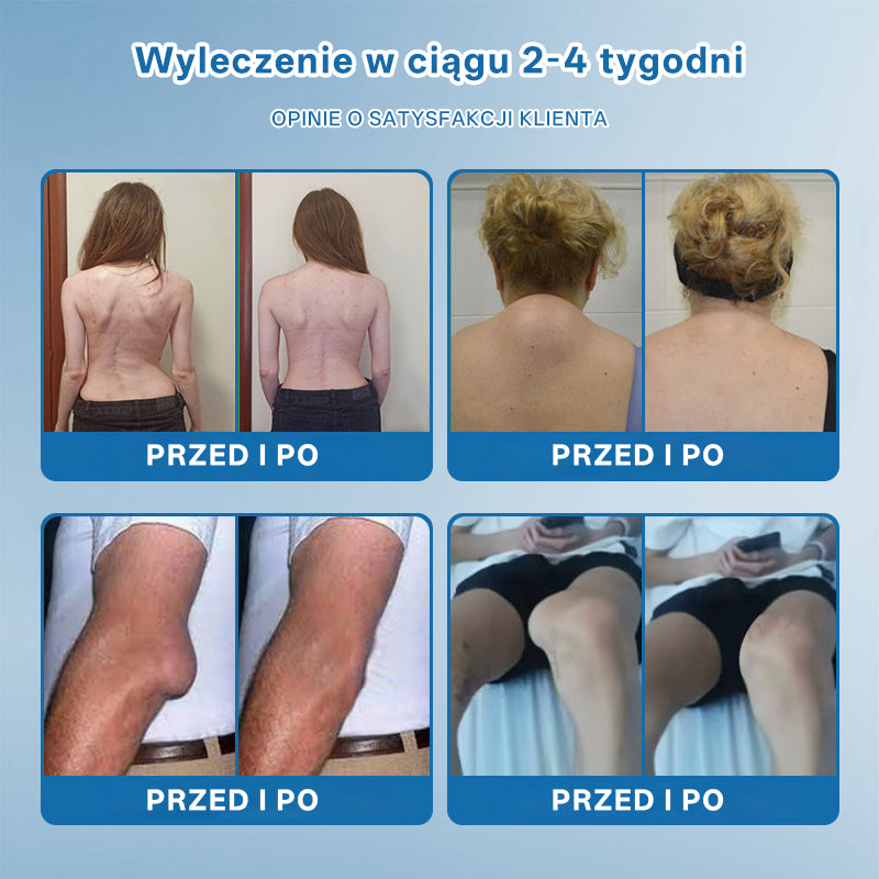 ⭐𝖯𝗂𝖼𝗱𝗈® BPC-157 Krem regenerujący stawy 🦴 Skutecznie łagodzi artretyzm, neuropatię, reumatyzm, kontuzje sportowe i wiele więcej 👍👍