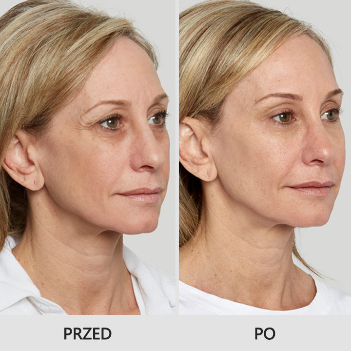 LIMETOW™ Retinol Eye Stick✅ redukuje drobne zmarszczki, opuchliznę i cienie pod oczami🌟
