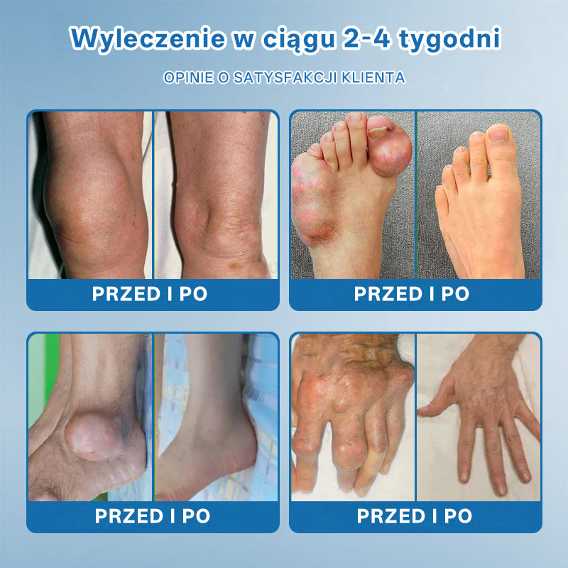 ⭐𝖯𝗂𝖼𝗱𝗈® BPC-157 Krem regenerujący stawy 🦴 Skutecznie łagodzi artretyzm, neuropatię, reumatyzm, kontuzje sportowe i wiele więcej 👍👍