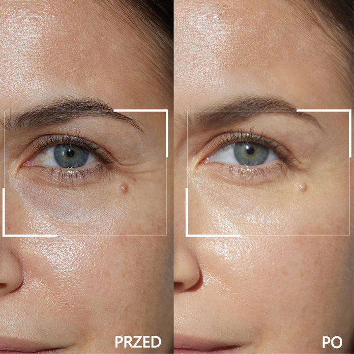 LIMETOW™ Retinol Eye Stick✅ redukuje drobne zmarszczki, opuchliznę i cienie pod oczami🌟