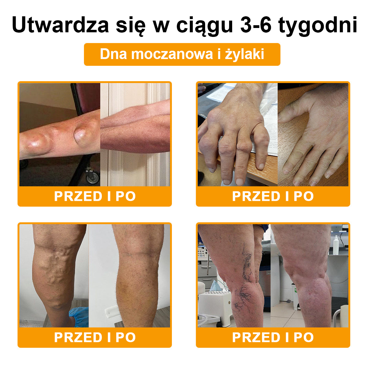 TLOPA® Toksyna botulinowa i jad pszczeli Balsam Łagodzący Ból i Leczenie Kości🐝🐝🌿 (Polecane dla seniorów przez ortopedów)🔥🔥