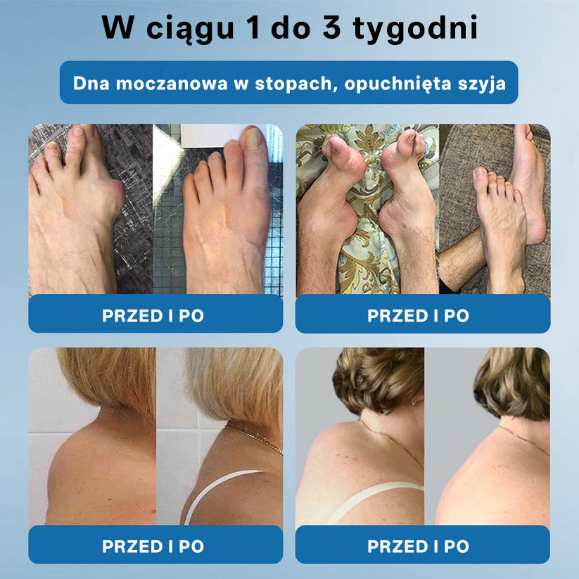 ⭐𝖯𝗂𝖼𝗱𝗈® BPC-157 Krem regenerujący stawy 🦴 Skutecznie łagodzi artretyzm, neuropatię, reumatyzm, kontuzje sportowe i wiele więcej 👍👍