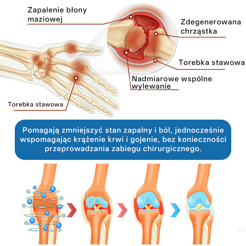 ⭐𝖯𝗂𝖼𝗱𝗈® BPC-157 Krem regenerujący stawy 🦴 Skutecznie łagodzi artretyzm, neuropatię, reumatyzm, kontuzje sportowe i wiele więcej 👍👍