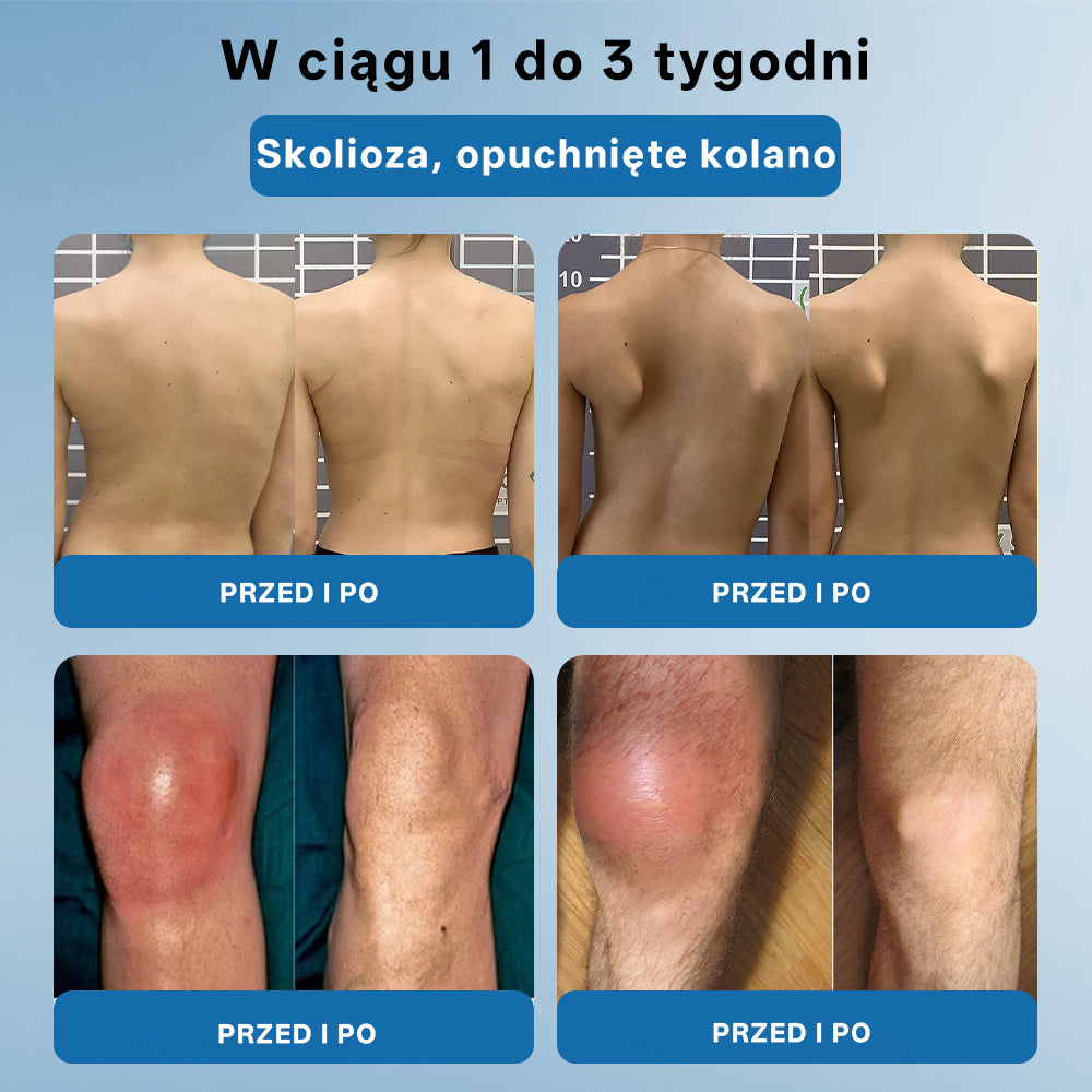 ⭐𝖯𝗂𝖼𝗱𝗈® BPC-157 Krem regenerujący stawy 🦴 Skutecznie łagodzi artretyzm, neuropatię, reumatyzm, kontuzje sportowe i wiele więcej 👍👍