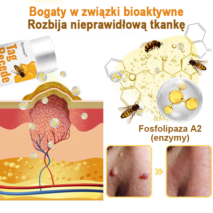 flysmus™ Sprej z jadem pszczelim do usuwania brodawek i znamion skórnych 🐝🐝🐝
