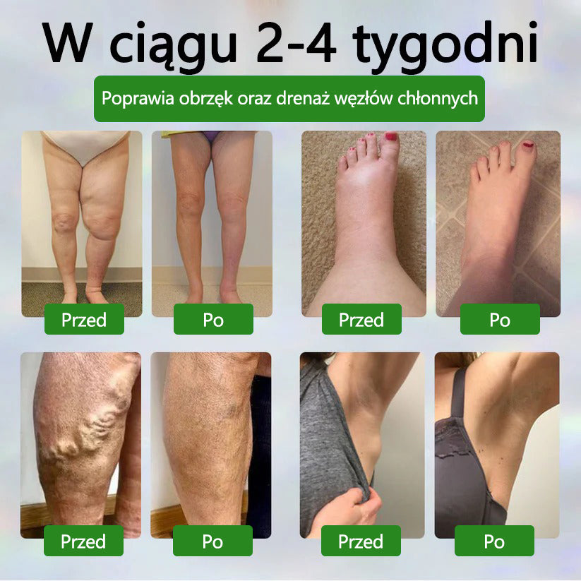 🌿🌿🌿ATTDX® Krem ziołowy łagodzący obrzęki z czarnuszką