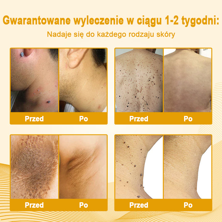 Ceoerty™ Żel antybakteryjny do naprawy skóry - zatwierdzony przez URPL 👨⚕️