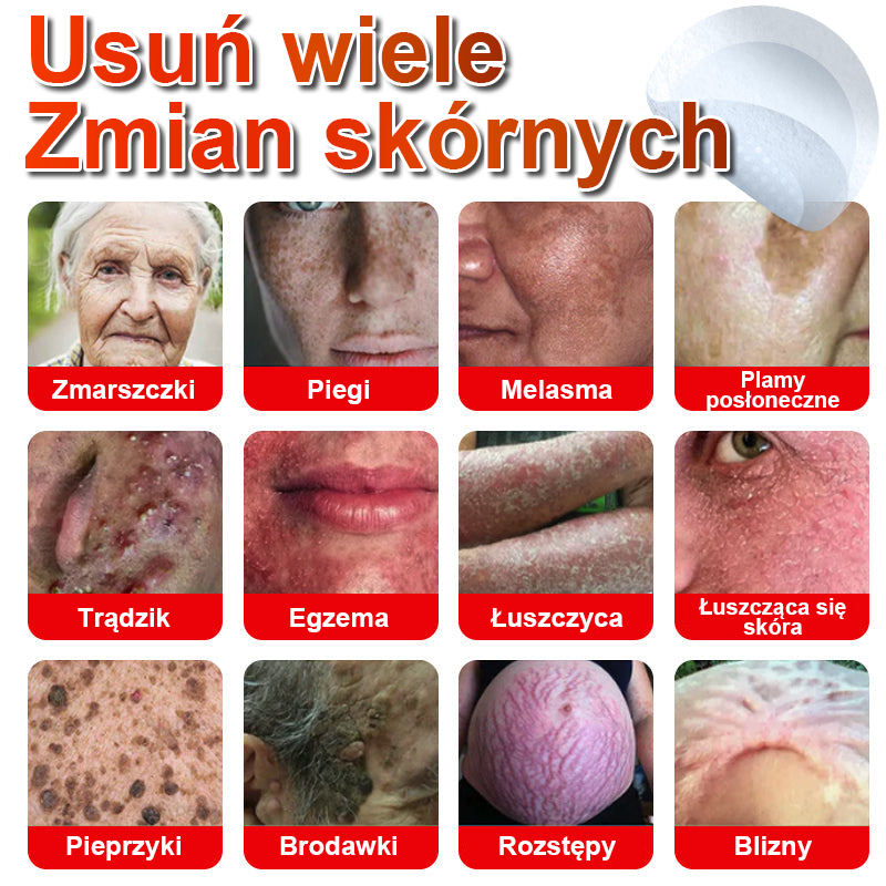 KUBOZN® Mikroigłowy botaniczny środek do usuwania narośli skórnych ✅✅✅✅wyprodukowano w Polsce