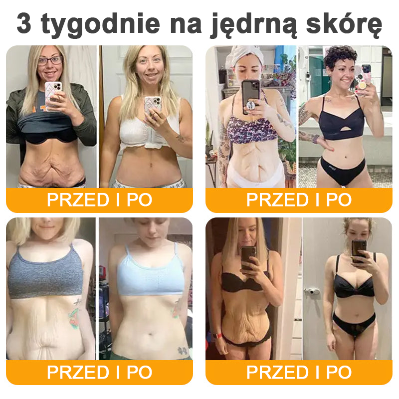 🔥🔥🔥🔥VLSVLS® Krem z jadem pszczelim do regeneracji skóry (👨⚕ odpowiedni dla wszystkich grup wiekowych, polecany przez AAD)