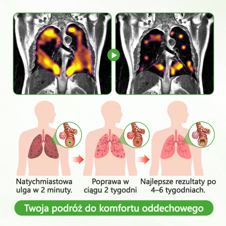 Ziołowy oczyszczacz płuc ATTDX® Mulleaf🌿🌿