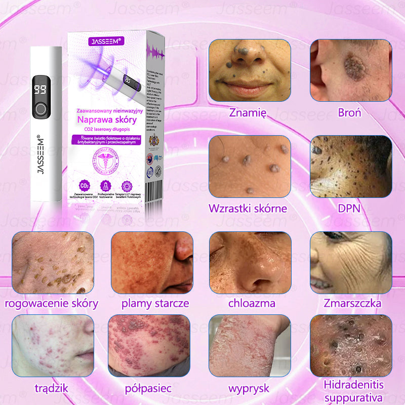 🔥🔥🔥𝐉𝐚𝐬𝐬𝐞𝐞𝐦® Zaawansowany nieinwazyjny laser CO₂ do naprawy skóry 🎉 (Delikatnie usuwa brodawki, znamiona, plamy starcze i narośla skórne – bez bólu, bez zamieszania!)