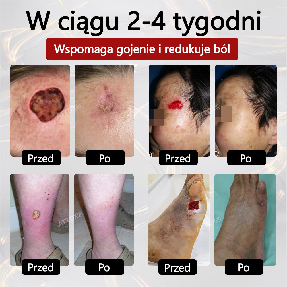 ⭐⭐ATTDX® GlucoseGuard krem ratunkowy dla skóry