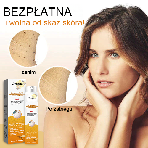 🧡Cvreoz Preparat do usuwania brodawek i znamion z jadem pszczelim Spray (👨⚕AAD POLECA)🐝🐝 (🔥Ostatni dzień promocji 80% taniej)