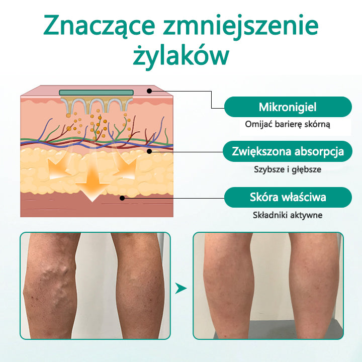 ✅✅✅✅Timilk® LegRenew Plaster na żylaki