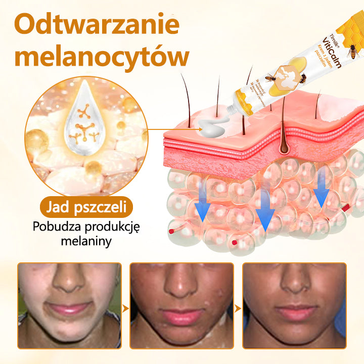 Timilk® VitiCalm krem z jadem pszczelim🌻🌻🌻