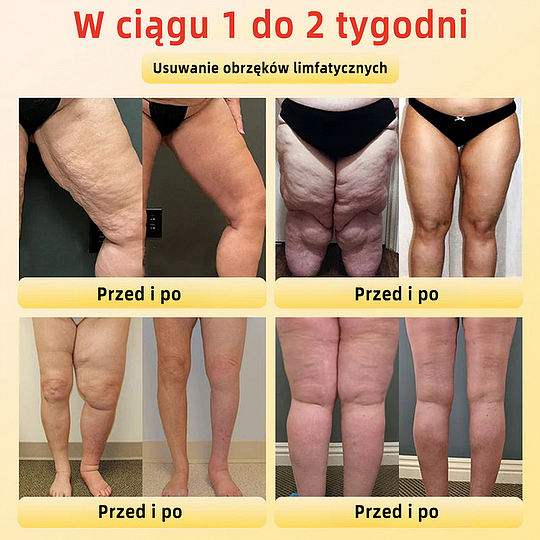 Anyidea™✅ Szorty modelujące z tytanowego włókna medycznego z samodzielnym podgrzewaniem i turmalinem✨✨ (⏰ Ostatnia szansa na zniżkę - ostatnie 30 minut! ⏰)✈️