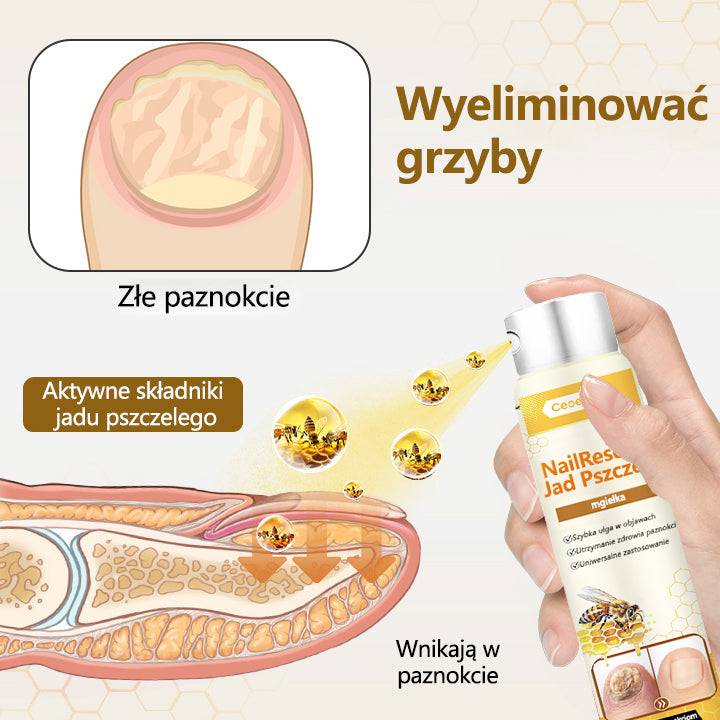 ✅【Oficjalny sklep flagowy】Ceoerty® spray z jadem pszczelim nailrescue