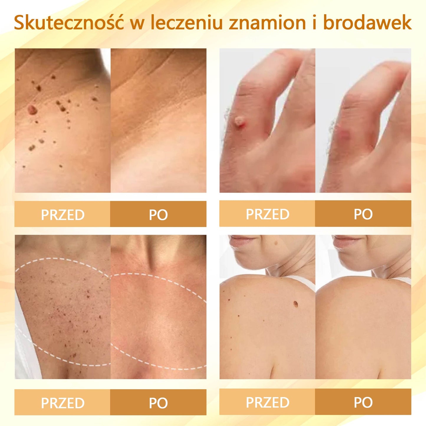 Krem regenerujący skórę Croaie® condense mellifera ⭐️⭐️
