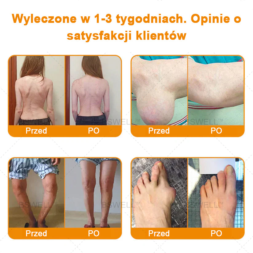 Lidokaina żel przeciwbólowy w kulce (zmniejsza obrzęk stawów, ból, sztywność, zaczerwienienie, ciepło, bóle i zmęczenie stawów), 4% lidokaina, glukozamina, MSM, arnika, chondroityna, witamina K2🔥