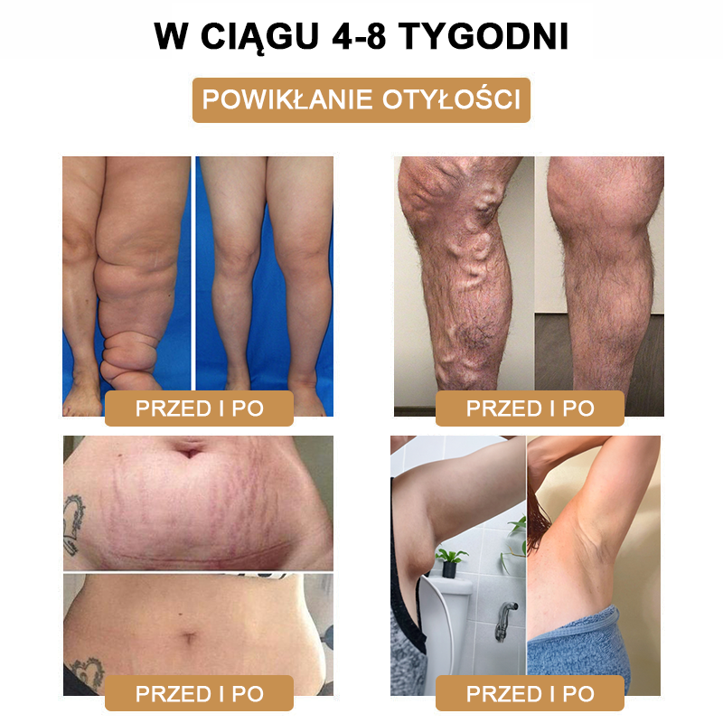 ✈️✈️2024 Nowa ultradźwiękowa opaska SlimPulse ™ do spalania tłuszczu i detoksykacji - równowaga energetyczna 🎁 (ograniczona zniżka czasowa + rekomendacja medyczna)