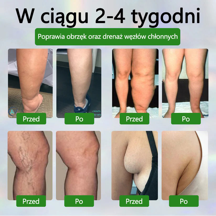 🌿🌿🌿ATTDX® Krem ziołowy łagodzący obrzęki z czarnuszką