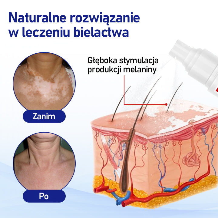 ⭐⭐⭐⭐Timilk® VitiClear Spray ziołowy