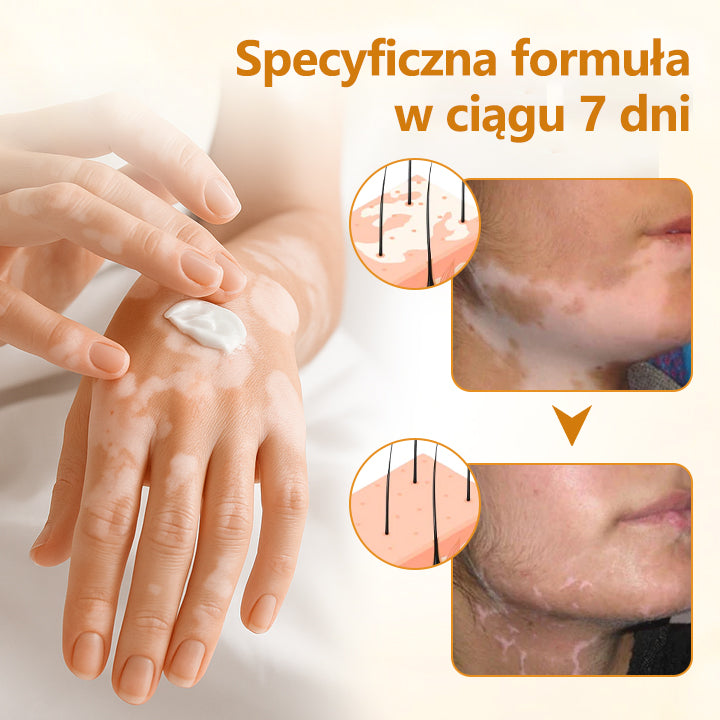 Timilk® VitiCalm krem z jadem pszczelim🌻🌻🌻