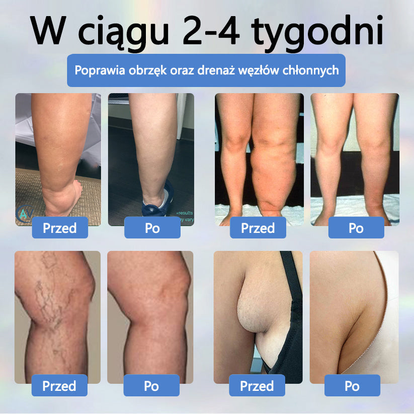 Detoksykujący krem ziołowy z czarnym kminkiem Cvreoz®🩹
