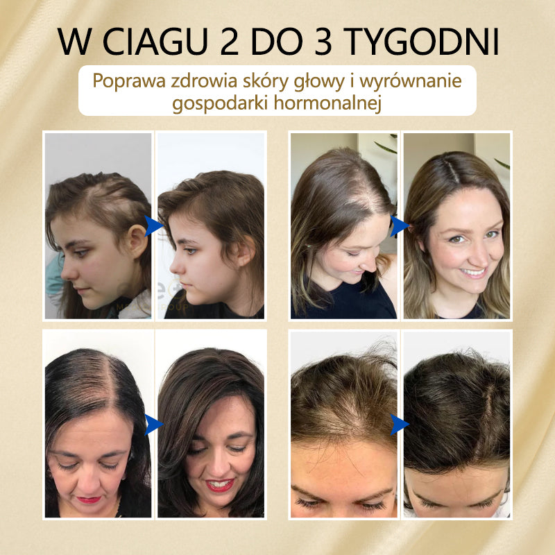 Timilk® VitaStrand Biotin Hair Growth Spray✅ Gęste, lśniące włosy w zaledwie kilka tygodni