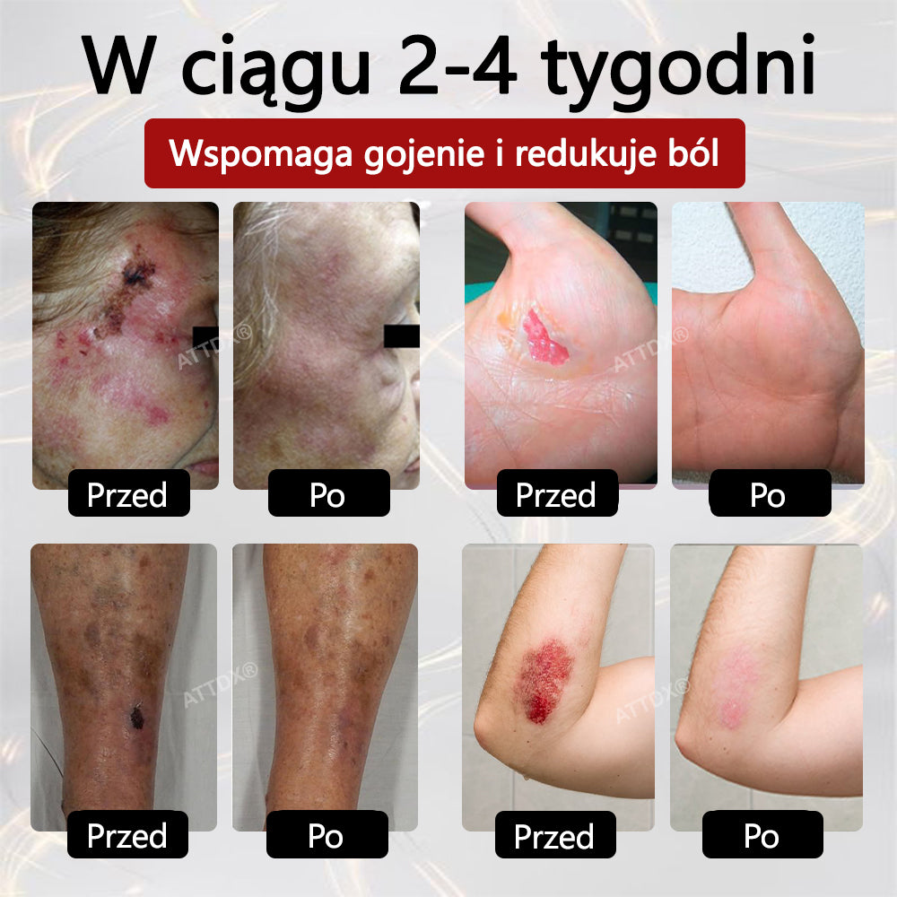 ⭐⭐ATTDX® GlucoseGuard krem ratunkowy dla skóry