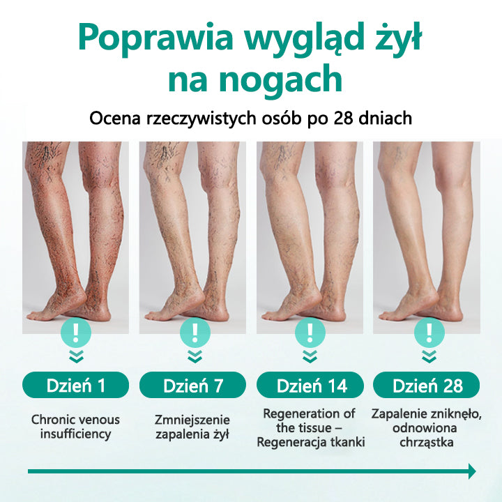 ✅✅✅✅Timilk® LegRenew Plaster na żylaki