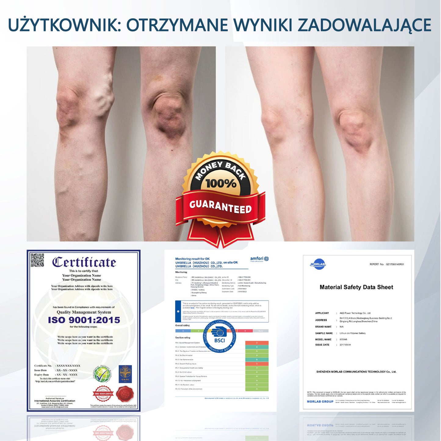 💧💧💧ATTDX® Krem ziołowy łagodzący obrzęki z czarnuszką